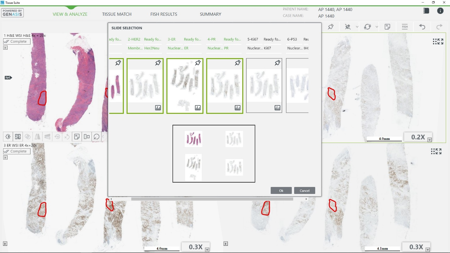 Tissue matching